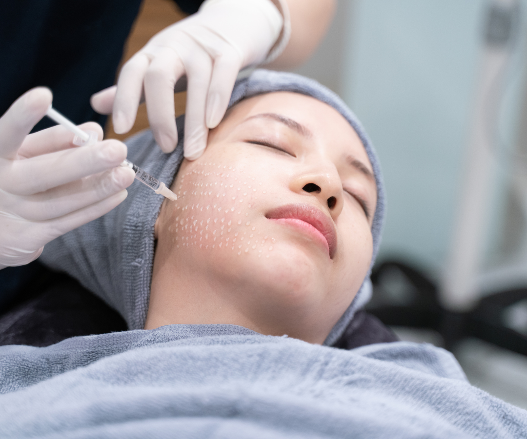 mesoterapia